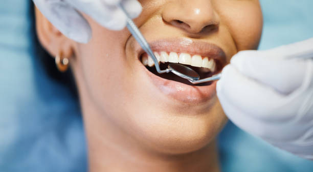 Best Emergency Wisdom Teeth Removal in Destrehan, LA