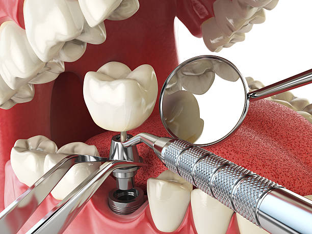 Best Emergency Dental Care for Broken or Chipped Teeth in Destrehan, LA